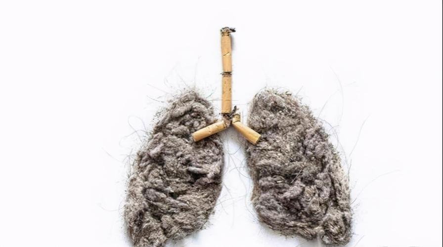 The culprit of lung cancer - smoking